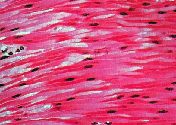 090002o4-5e25-584x416.png