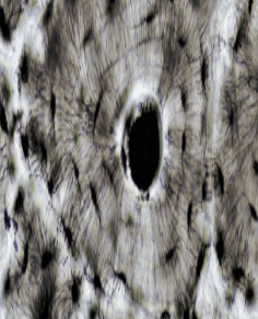 090002u2-de27-236x292.png