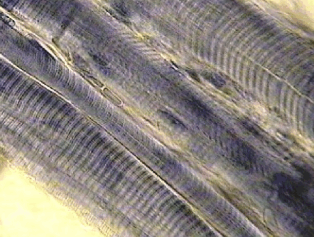 0900037j-1bd0-621x469.png