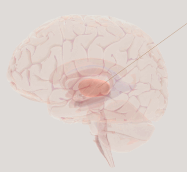 090068d4-bfc6-378x349.png