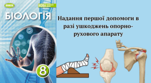 Надання першої допомоги в разі ушкоджень опорно-рухового апарату 8 клас НУШ