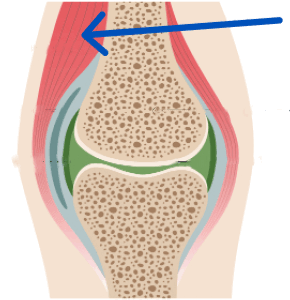 0900cccl-bf8d-290x300.png