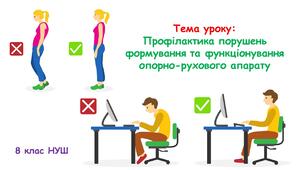 Презентація з біології "Профілактика порушень формування та функціонування опорно-рухового апарату." 8 клас НУШ