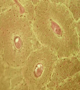 0900fohu-b9d0-312x353.png