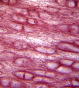 0900fohv-1df6-298x334.png
