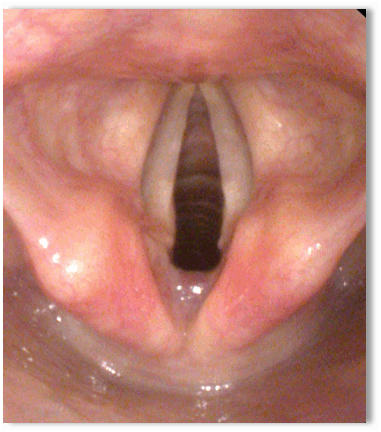 0900hbma-d147-381x432.png