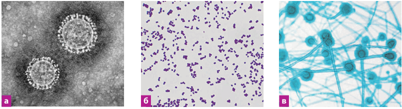 0900lh5l-34d8-807x219.png