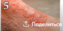 0900t5jf-5918-204x102.png