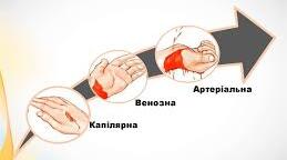 37.Тема: Кровотечі: надання першої допомоги. Серцево-судинні захворювання та їх профілактика.