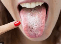 0900zxln-3875-212x155.png