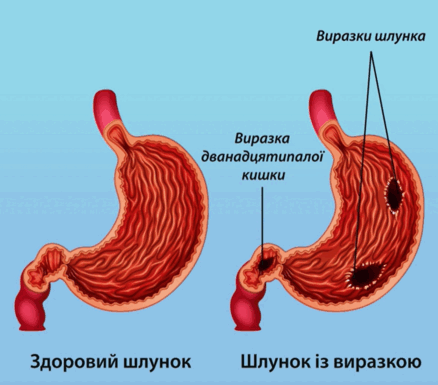 09011827-692c-438x385.png