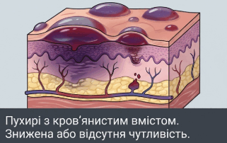 09011nid-04e2-321x202.png