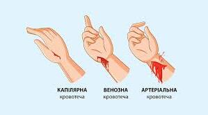 Презентація до уроку "Кровотечі та перша допомога"