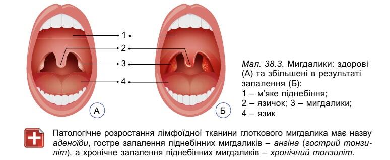 09013t2c-4ac1-774x317.jpg