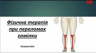 Презентація «Фізична терапія при переломах гомілки»