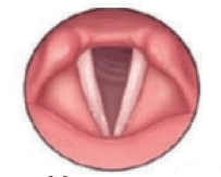 090165l1-abeb-203x162.png