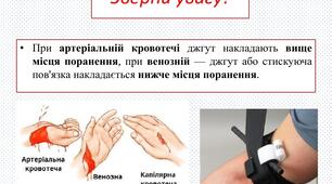 Практичне заняття “Перша домедична допомога при кровотечах”