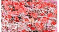 33. Будова і функції лейкоцитів і тромбоцитів. Зсідання крові