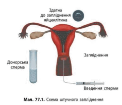 0901ciyu-34f7-242x208.png