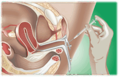0901cj1c-b30f-241x155.png
