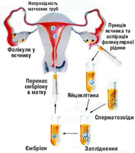 0901cj4d-0964-329x372.png