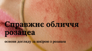 Справжнє обличчя розацеа
