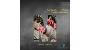 Тест алгоритма MARCH