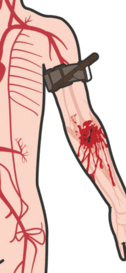 0901w88u-411e-126x273.png