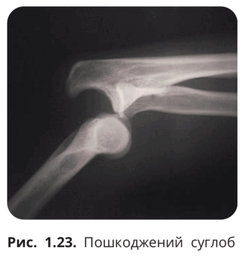 090203xj-bccb-355x371.png