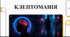 Відеоогляд "Клептоманія"