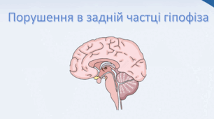 Презентація на тему "Порушення в задній частці гіпофіза"