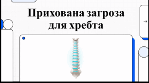 Відеоогляд "Міжнародний день поінформованості про сколіоз"