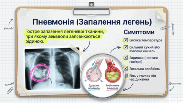 090261lk-112d-373x210.png