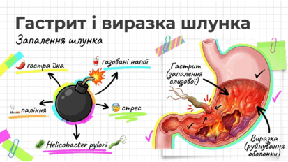 0902639y-cd09-413x232.png