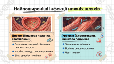 090263cx-e717-399x225.png
