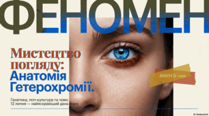 12 липня - День різнокольорових очей